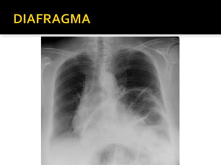 Aula prática de radiologia