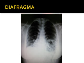 Aula prática de radiologia