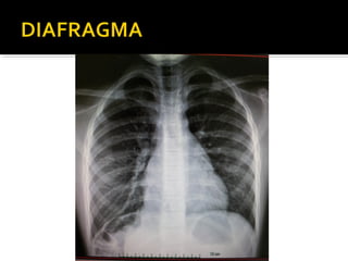 Aula prática de radiologia