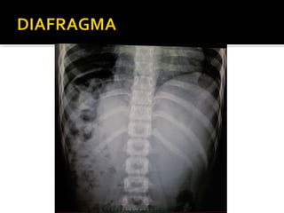 Aula prática de radiologia