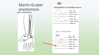 Martin-Gruber
anastomosis
stimulation of median nerve
Q6
1
Type 1 anastomosis
 