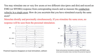 You may stimulate one or very few axons at two different sites (prox and dist) and record an
EMG (or SFEMG) response from corresponding muscle and so measure the conduction
velocity in a single axon. How do you ascertain that you have stimulated exactly the same
axon?
Stimulate distally and proximally simultaneously. If you stimulate the same axon, no
response will be seen from the proximal stimulation.
Distal and proximal stimulation activates DIFFERENT axons
since dual stimulation does not block the proximal response
Proximal response disappears on dual stimulation, collision
 