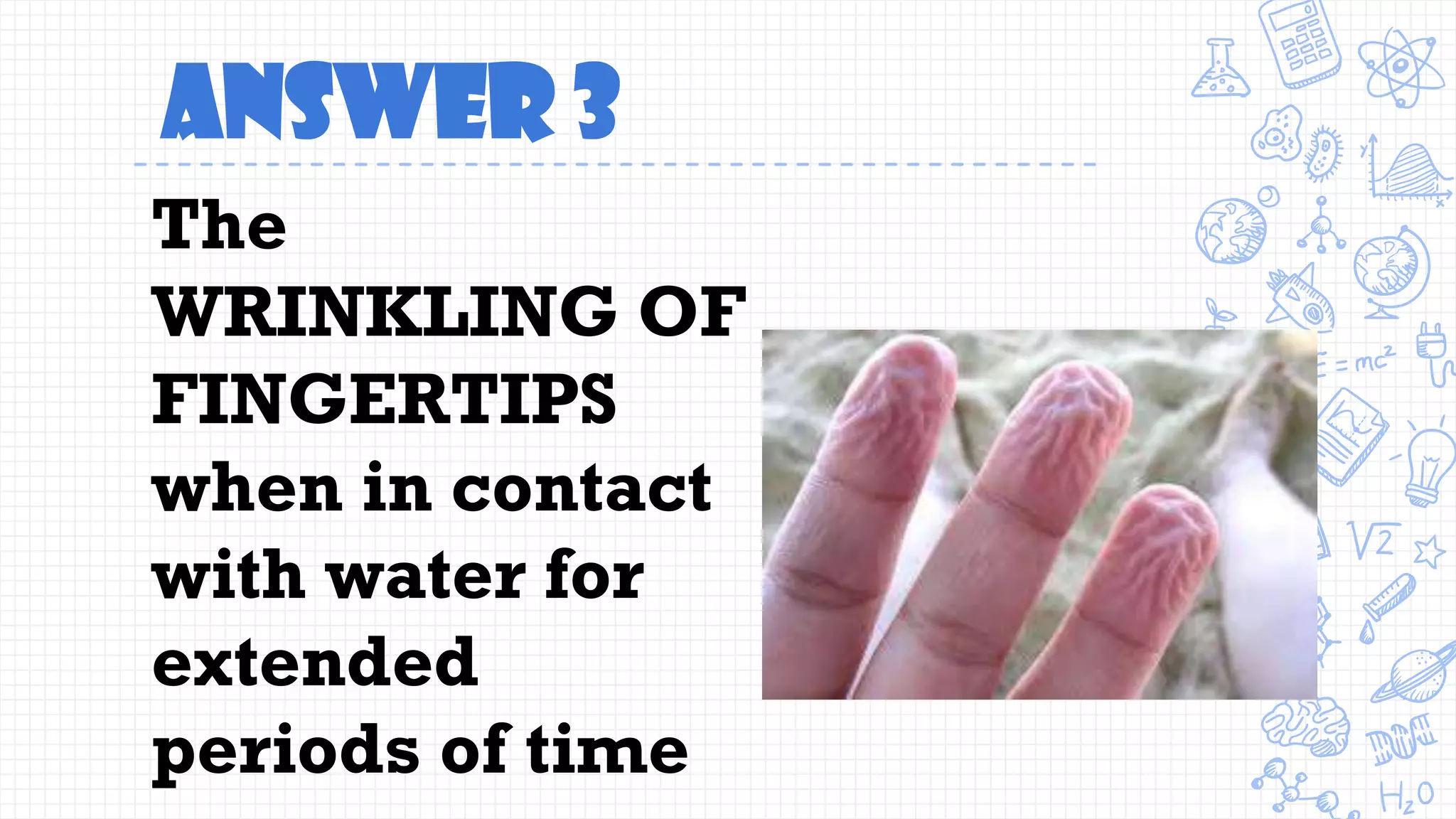 Answer 3
The
WRINKLING OF
FINGERTIPS
when in contact
with water for
extended
periods of time
 
