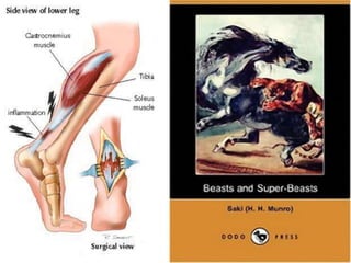 ANSWER:Memorial to the victims of the Hamburg bombings. Inscription reads: "On the night of 30th July 1943, 370 persons perished in the air-raid shelter on the Hamburgerstrasse in a bombing raid. Remember these dead. Never again fascism. Never again war".