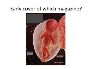 Early cover of which magazine? 