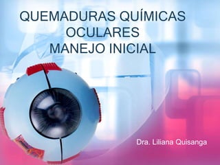 QUEMADURAS QUÍMICAS
OCULARES
MANEJO INICIAL
Dra. Liliana Quisanga
 