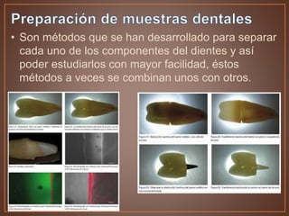 • Son métodos que se han desarrollado para separar
cada uno de los componentes del dientes y así
poder estudiarlos con mayor facilidad, éstos
métodos a veces se combinan unos con otros.
 