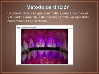 • Se puede observar que el esmalte aparece de color azul
y la dentina amarilla, este método permite ver muestras
contaminantes en el diente.
 