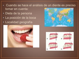 • Cuando se hace el análisis de un diente es preciso
tomar en cuenta:
• Dieta de la persona
• La posición de la boca
• Localidad geografía
 