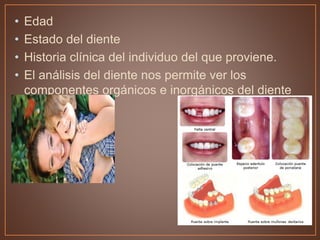 • Edad
• Estado del diente
• Historia clínica del individuo del que proviene.
• El análisis del diente nos permite ver los
componentes orgánicos e inorgánicos del diente
 