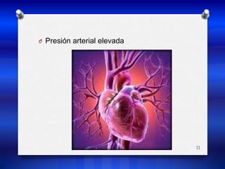 Presión arterial elevada11