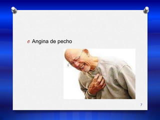 Angina de pecho7