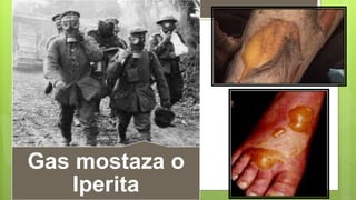 Gas mostaza o
Iperita
 