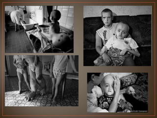 Acidentes Radiotivos e Nucleares