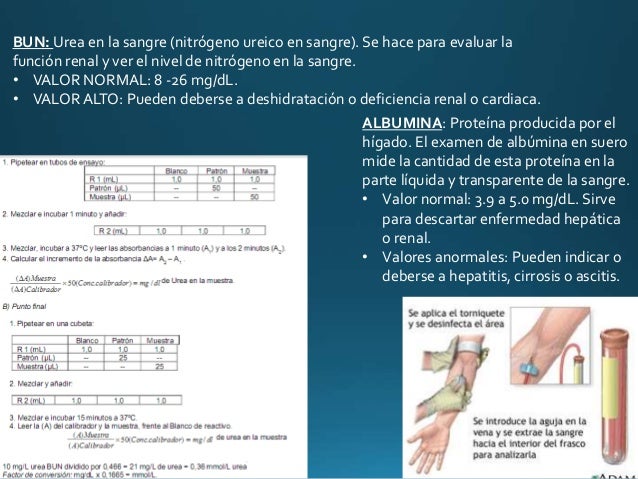 Química sanguínea Química sanguínea