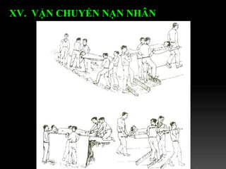 XV.  VẬN CHUYỂN NẠN NHÂN   