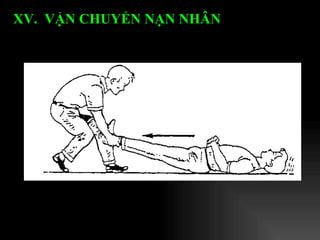 XV.  VẬN CHUYỂN NẠN NHÂN   