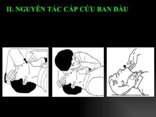 II. NGUYÊN TẮC CẤP CỨU BAN ĐẦU   