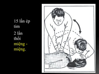15 lần ép tim  2 lần thổi  miệng - miệng . 
