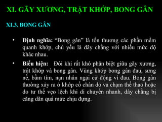 Định nghĩa:  “Bong gân” là tổn thương các phần mềm quanh khớp, chủ yếu là dây chằng với nhiều mức độ khác nhau. Biểu hiện:  Đôi khi rất khó phân biệt giữa gãy xương, trật khớp và bong gân. Vùng khớp bong gân đau, sưng nề, bầm tím, nạn nhân ngại cử động vì đau. Bong gân thường xảy ra ở khớp cổ chân do va chạm thể thao hoặc do tư thế vẹo lệch khi di chuyển nhanh, dây chằng bị căng dãn quá mức chịu đựng. XI.3. BONG GÂN XI. GÃY XƯƠNG, TRẬT KHỚP, BONG GÂN   