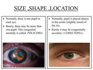 Polykorie Examination of pupil by pushkar dhir | PPTX
