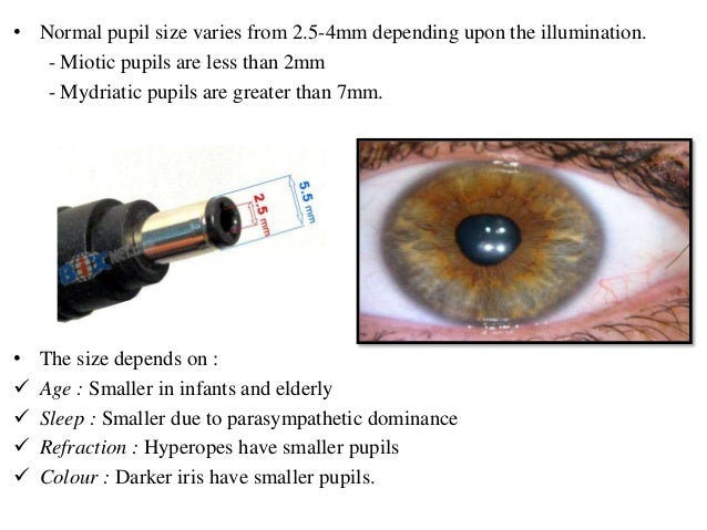 constricted pupil size