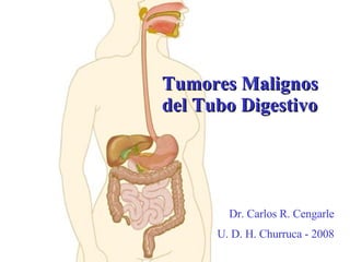 Tumores Malignos del Tubo Digestivo Dr. Carlos R. Cengarle U. D. H. Churruca - 2008 