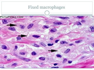 Fixed macrophages
 