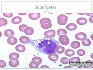 Monocytes
 