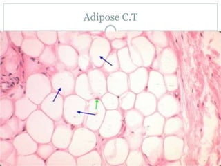 Adipose C.T
 