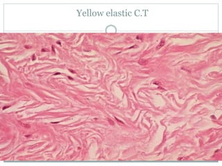 Yellow elastic C.T
 