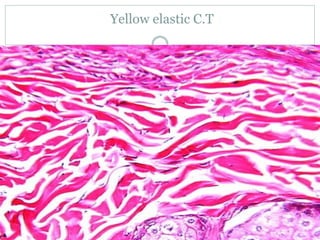 Yellow elastic C.T
 