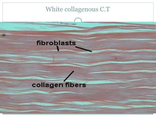 White collagenous C.T
 