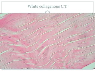 White collagenous C.T
 