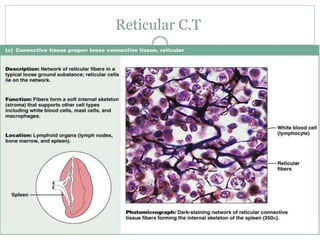 Reticular C.T
 