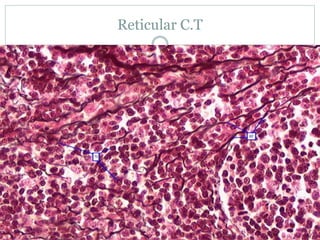 Reticular C.T
 