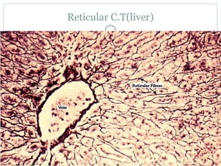 Reticular C.T(liver)
 