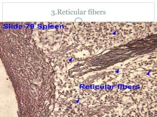 3.Reticular fibers
 