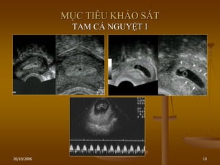 20/10/2006 10
MỤC TIÊU KHẢO SÁT
TAM CÁ NGUYỆT I
 