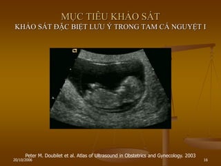20/10/2006 16
MỤC TIÊU KHẢO SÁT
KHẢO SÁT ĐẶC BIỆT LƢU Ý TRONG TAM CÁ NGUYỆT I
Peter M. Doubilet et al. Atlas of Ultrasound in Obstetrics and Gynecology. 2003
 