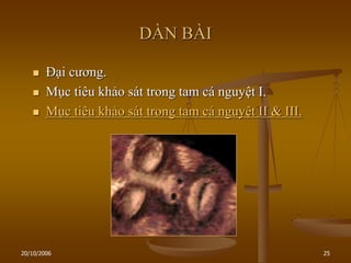 20/10/2006 25
DÀN BÀI
 Đại cƣơng.
 Mục tiêu khảo sát trong tam cá nguyệt I.
 Mục tiêu khảo sát trong tam cá nguyệt II & III.
 