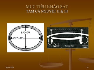 20/10/2006 28
MỤC TIÊU KHẢO SÁT
TAM CÁ NGUYỆT II & III
 