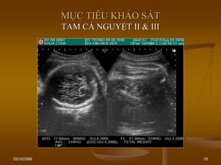 20/10/2006 29
MỤC TIÊU KHẢO SÁT
TAM CÁ NGUYỆT II & III
 