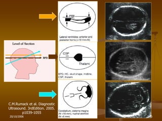 20/10/2006 30
C.M.Rumack et al. Diagnostic
Ultrasound. 3rdEdition. 2005.
p1039-1055
 