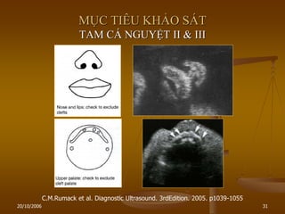 20/10/2006 31
MỤC TIÊU KHẢO SÁT
TAM CÁ NGUYỆT II & III
C.M.Rumack et al. Diagnostic Ultrasound. 3rdEdition. 2005. p1039-1055
 