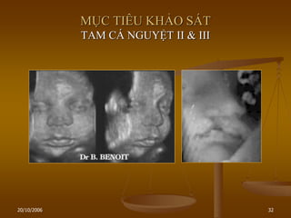 20/10/2006 32
MỤC TIÊU KHẢO SÁT
TAM CÁ NGUYỆT II & III
 