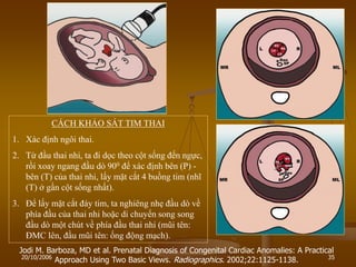 20/10/2006 35
Jodi M. Barboza, MD et al. Prenatal Diagnosis of Congenital Cardiac Anomalies: A Practical
Approach Using Two Basic Views. Radiographics. 2002;22:1125-1138.
CÁCH KHẢO SÁT TIM THAI
1. Xác định ngôi thai.
2. Từ đầu thai nhi, ta đi dọc theo cột sống đến ngực,
rồi xoay ngang đầu dò 900 để xác định bên (P) -
bên (T) của thai nhi, lấy mặt cắt 4 buồng tim (nhĩ
(T) ở gần cột sống nhất).
3. Để lấy mặt cắt đáy tim, ta nghiêng nhẹ đầu dò về
phía đầu của thai nhi hoặc di chuyển song song
đầu dò một chút về phía đầu thai nhi (mũi tên:
ĐMC lên, đầu mũi tên: ống động mạch).
 