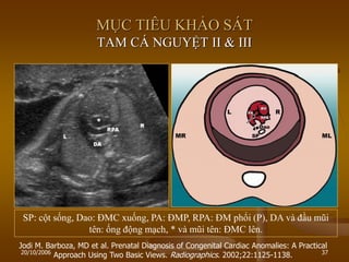 20/10/2006 37
Jodi M. Barboza, MD et al. Prenatal Diagnosis of Congenital Cardiac Anomalies: A Practical
Approach Using Two Basic Views. Radiographics. 2002;22:1125-1138.
MỤC TIÊU KHẢO SÁT
TAM CÁ NGUYỆT II & III
SP: cột sống, Dao: ĐMC xuống, PA: ĐMP, RPA: ĐM phổi (P), DA và đầu mũi
tên: ống động mạch, * và mũi tên: ĐMC lên.
 