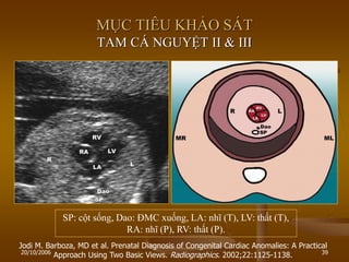 20/10/2006 39
Jodi M. Barboza, MD et al. Prenatal Diagnosis of Congenital Cardiac Anomalies: A Practical
Approach Using Two Basic Views. Radiographics. 2002;22:1125-1138.
MỤC TIÊU KHẢO SÁT
TAM CÁ NGUYỆT II & III
SP: cột sống, Dao: ĐMC xuống, LA: nhĩ (T), LV: thất (T),
RA: nhĩ (P), RV: thất (P).
 