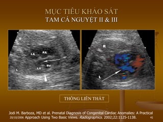20/10/2006 41
Jodi M. Barboza, MD et al. Prenatal Diagnosis of Congenital Cardiac Anomalies: A Practical
Approach Using Two Basic Views. Radiographics. 2002;22:1125-1138.
MỤC TIÊU KHẢO SÁT
TAM CÁ NGUYỆT II & III
THÔNG LIÊN THẤT
 